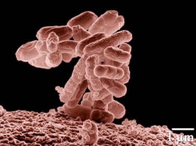 E. coli Amstelveen